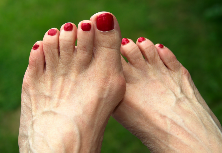 Adjusting to Wearing Toe Spacers: A Guide for Improved Foot Health