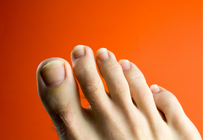 How Long Does It Take Toe Spreaders to Work: Unveiling Timelines for Foot Health Benefits