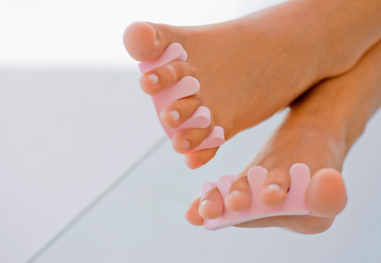 How Often Should Toe Spacers Be Replaced? Important Factors To Consider