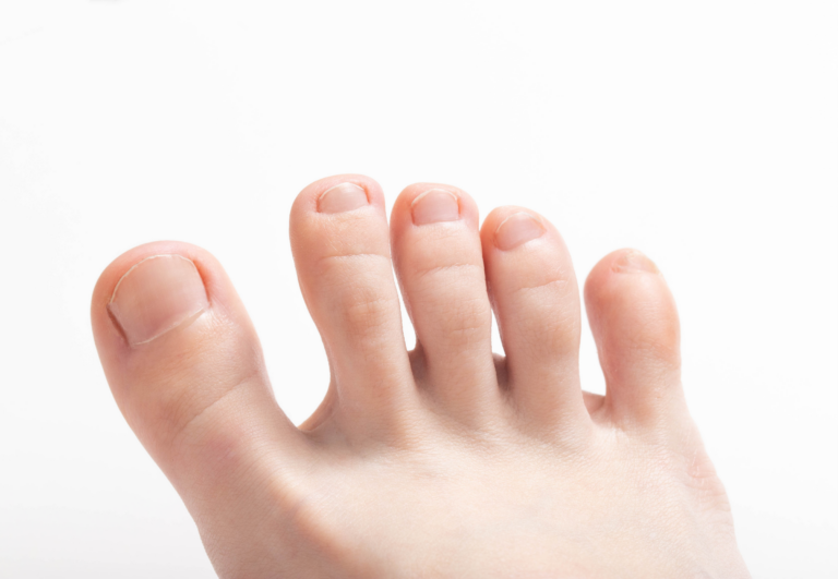 How to Use Toe Spacers Correctly: A Step-by-Step Guide
