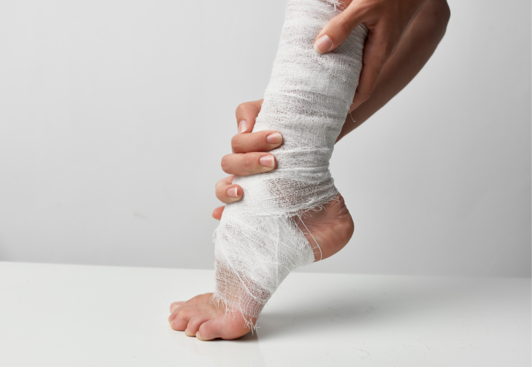 How to Use Toe Spacers for Injury Recovery: Enhancing Healing After Sports Injuries