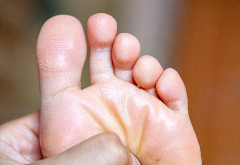 Toe Alignment Exercises: Enhancing Foot Health and Mobility