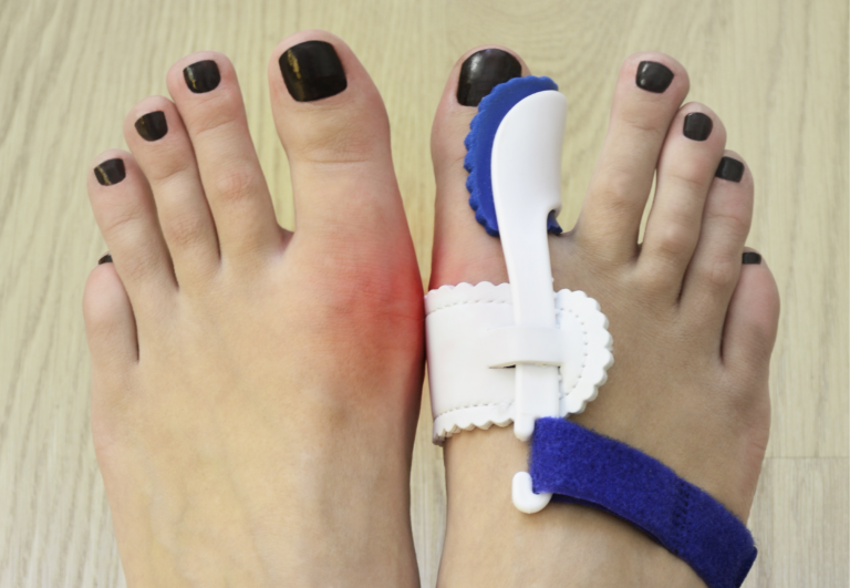 Toe Spacer Stretches: Enhance Your Foot Mobility and Flexibility