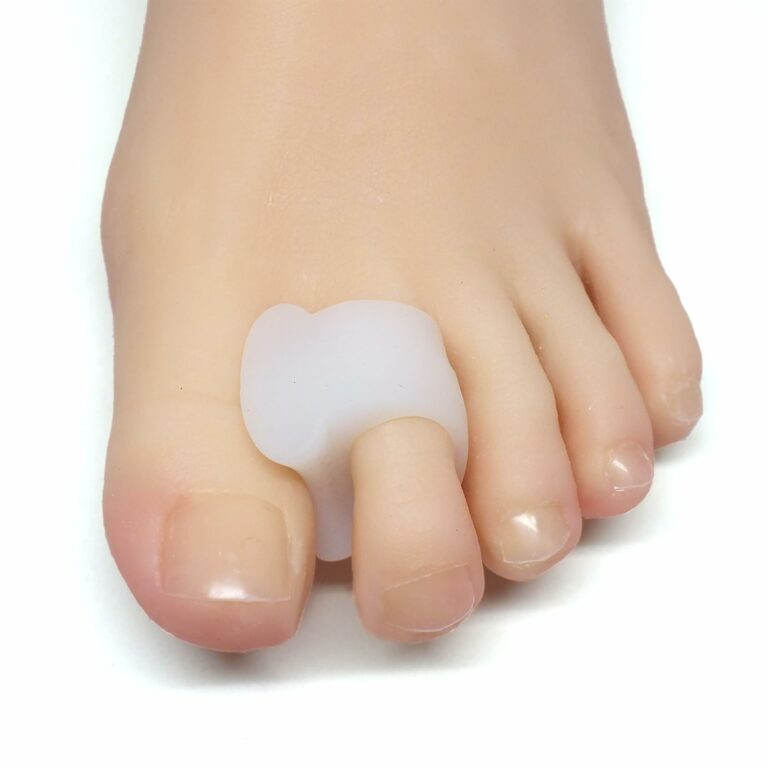 Best Toe Spacers for Overlapping Toes: A Guide to Comfort and Corrective Support